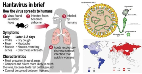 hantavirus