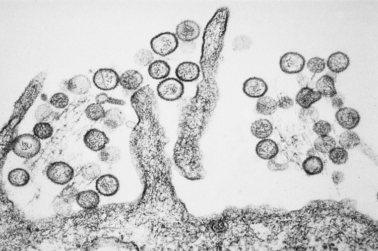 Hantavirus Explained: Symptoms, Causes, Prevention & Latest 2026 Updates